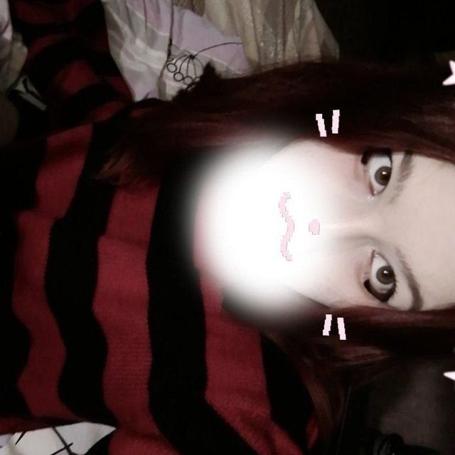 epileptic kid
