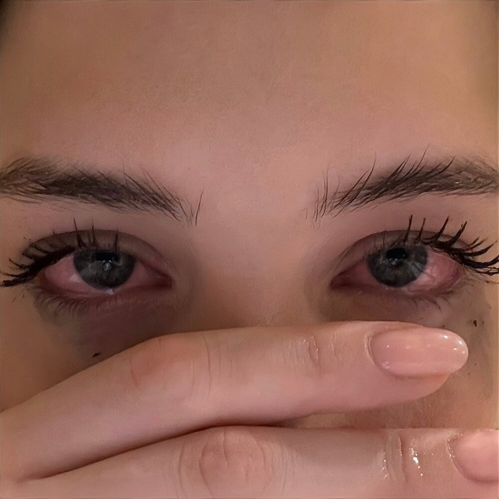 Красные глаза